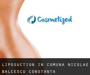 Liposuction in Comuna Nicolae Bălcescu (Constanţa)