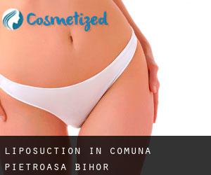 Liposuction in Comuna Pietroasa (Bihor)