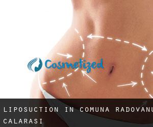 Liposuction in Comuna Radovanu (Călăraşi)