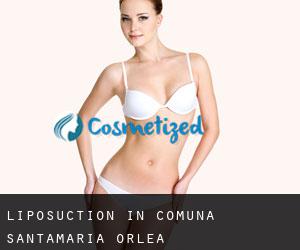 Liposuction in Comuna Sântămăria-Orlea