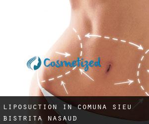 Liposuction in Comuna Şieu (Bistriţa-Năsăud)