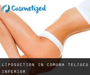 Liposuction in Comuna Teliucu Inferior