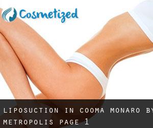 Liposuction in Cooma-Monaro by metropolis - page 1
