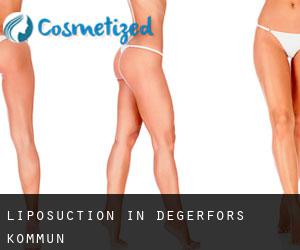 Liposuction in Degerfors Kommun