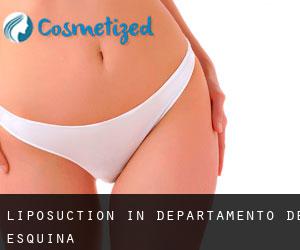 Liposuction in Departamento de Esquina