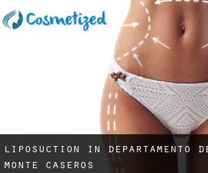 Liposuction in Departamento de Monte Caseros