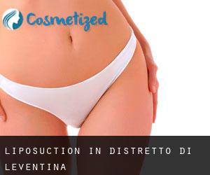 Liposuction in Distretto di Leventina