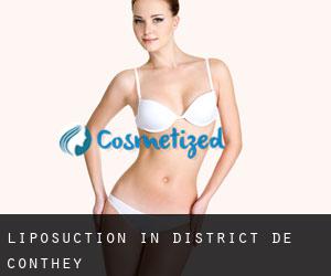 Liposuction in District de Conthey
