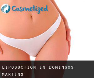 Liposuction in Domingos Martins