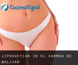 Liposuction in El Carmen de Bolívar