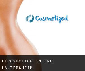 Liposuction in Frei-Laubersheim
