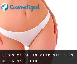 Liposuction in Gaspésie-Îles-de-la-Madeleine