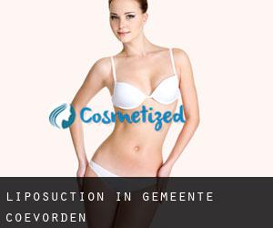 Liposuction in Gemeente Coevorden