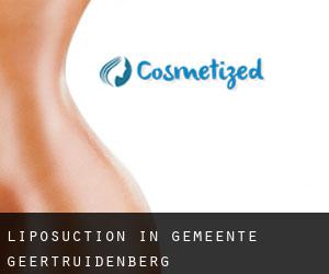 Liposuction in Gemeente Geertruidenberg