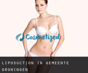 Liposuction in Gemeente Groningen