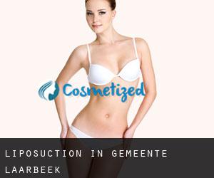 Liposuction in Gemeente Laarbeek