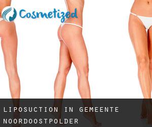 Liposuction in Gemeente Noordoostpolder