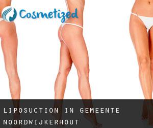Liposuction in Gemeente Noordwijkerhout