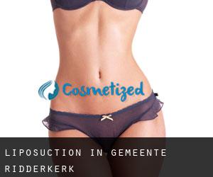 Liposuction in Gemeente Ridderkerk