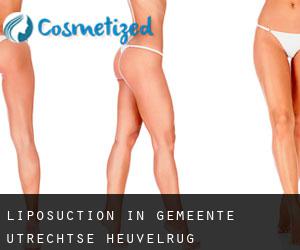 Liposuction in Gemeente Utrechtse Heuvelrug