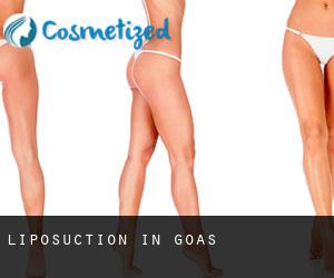 Liposuction in Goas