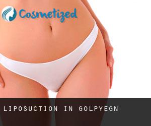 Liposuction in Golpāyegān