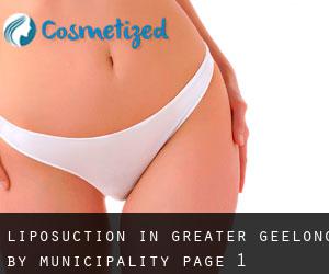 Liposuction in Greater Geelong by municipality - page 1