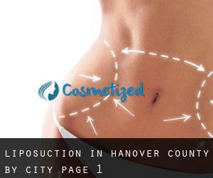 Liposuction in Hanover County by city - page 1