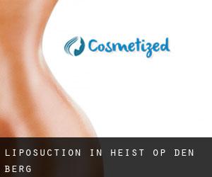 Liposuction in Heist-op-den-Berg