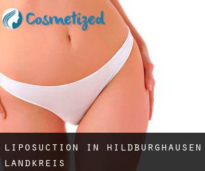 Liposuction in Hildburghausen Landkreis