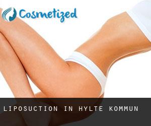 Liposuction in Hylte Kommun