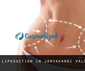Liposuction in Järvakandi vald