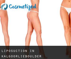 Liposuction in Kalgoorlie/Boulder