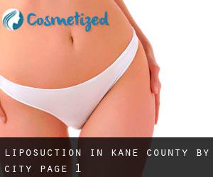 Liposuction in Kane County by city - page 1