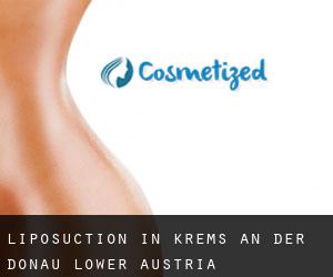 Liposuction in Krems an der Donau (Lower Austria)