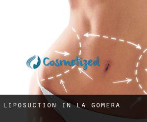 Liposuction in La Gomera