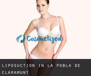 Liposuction in La Pobla de Claramunt