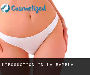 Liposuction in La Rambla