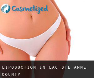 Liposuction in Lac Ste. Anne County