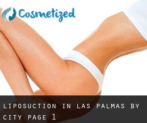Liposuction in Las Palmas by city - page 1