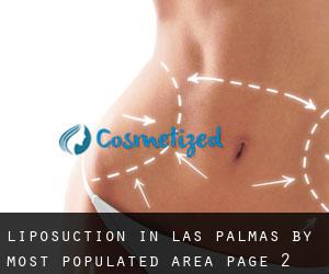 Liposuction in Las Palmas by most populated area - page 2