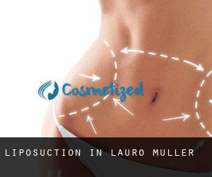 Liposuction in Lauro Muller