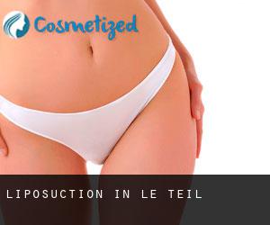 Liposuction in Le Teil
