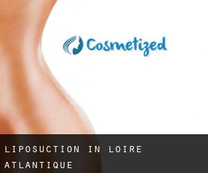 Liposuction in Loire-Atlantique