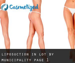 Liposuction in Lot by municipality - page 1
