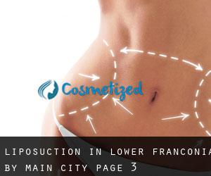 Liposuction in Lower Franconia by main city - page 3