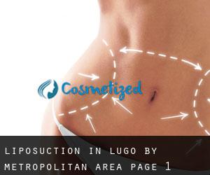 Liposuction in Lugo by metropolitan area - page 1