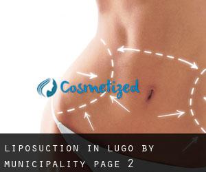 Liposuction in Lugo by municipality - page 2