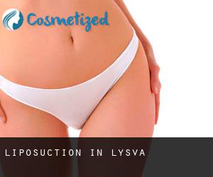 Liposuction in Lys'va