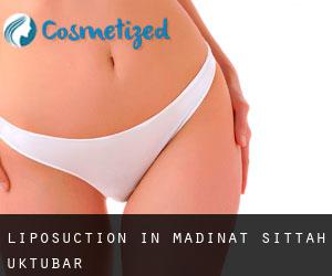 Liposuction in Madīnat Sittah Uktūbar